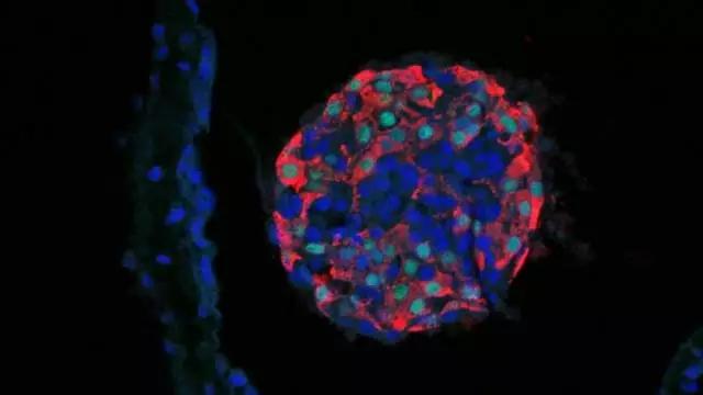 顶级期刊两文并发：干细胞治愈I型糖尿病希望初现
