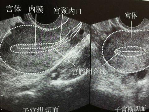 怀孕跟子宫内膜有关系吗,子宫内膜的厚薄与怀孕之间的关系