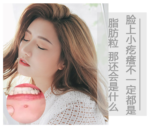 儿童脸上长一粒粒小疙瘩像脂肪粒,脸上类似脂肪粒的疙瘩是什么