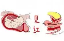 孕38周胎动几乎没有了,孕妈别把胎动不当回事