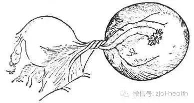 生完孩子卵巢摘除,妈妈切除子宫和卵巢