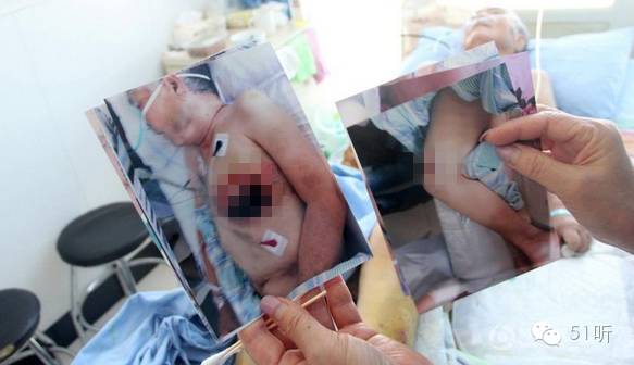 山东儿媳被公婆虐待致死,山东23岁的女子被公婆虐待致死