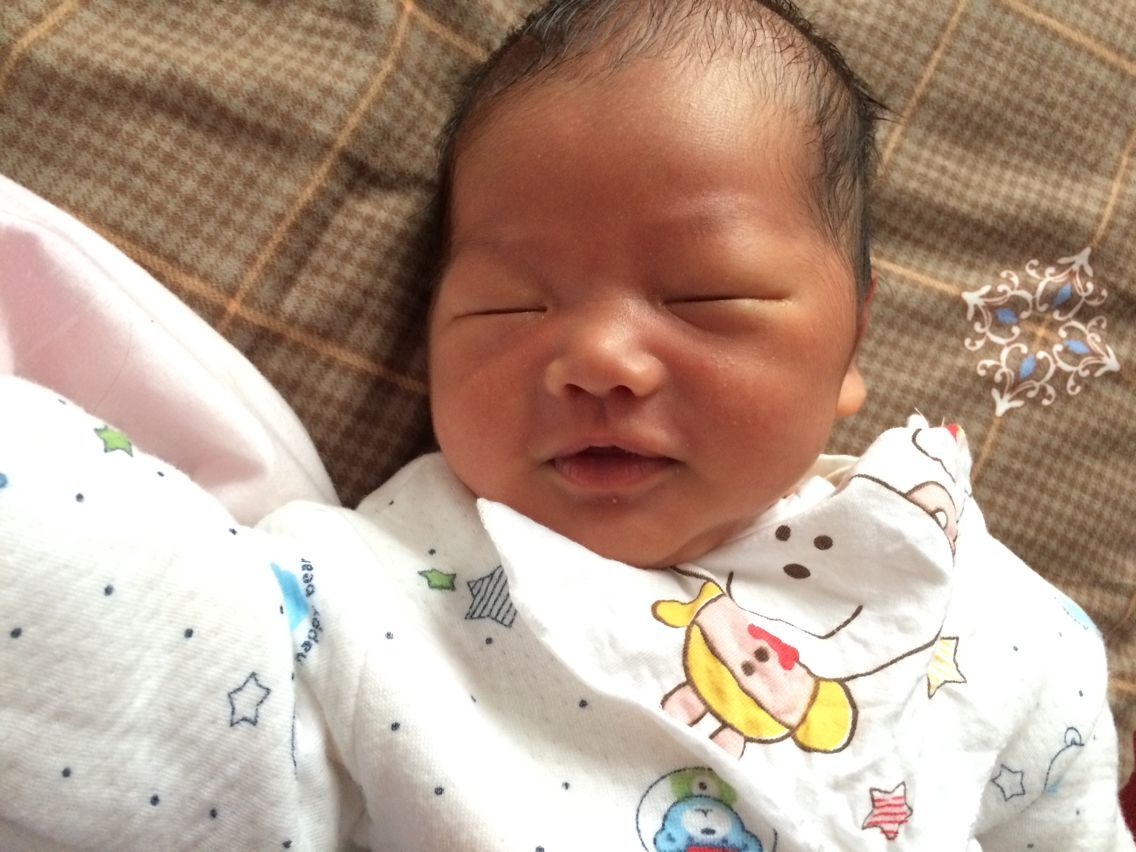 我就是妇产科主任说的30年难得一见的病人