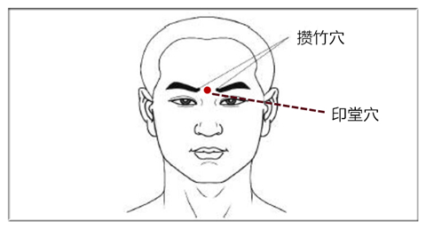 鼻炎鼻塞不通气按摩什么穴位,过敏性鼻炎按摩哪几个穴位最有效