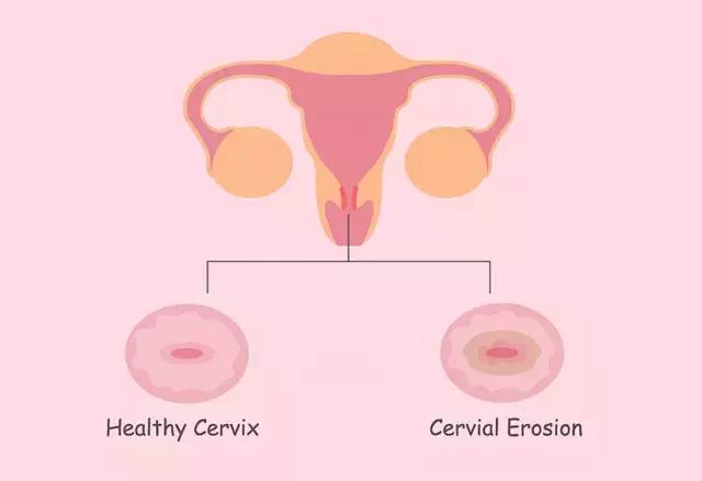 困扰女性的几大问题,困扰了一个女性30年的疾病