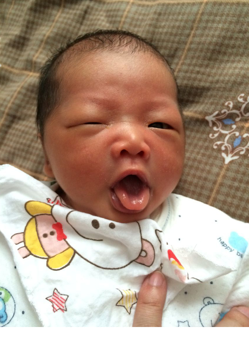 我就是妇产科主任说的30年难得一见的病人