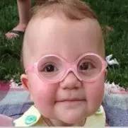 大开眼界视力矫正,一只眼弱视是怎么回事