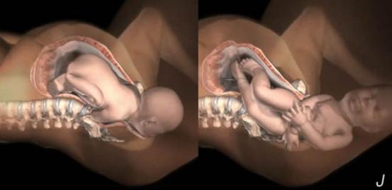 准备顺产的孕妈需要注意什么,顺产妈妈需要准备什么