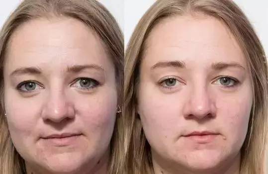 熬夜会让你变得多丑,熬夜变丑了还要继续熬夜么