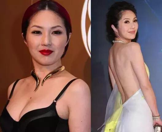 极速瘦脸打造小v脸神器,打造小v脸面部提拉