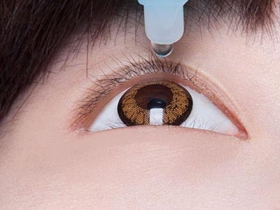 治疗麦粒肿最快的方法,左氧氟沙星治疗麦粒肿