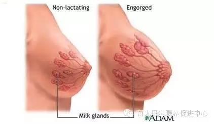 产后涨奶的十大忠告,从开始断奶乳房就没涨过怎么回事