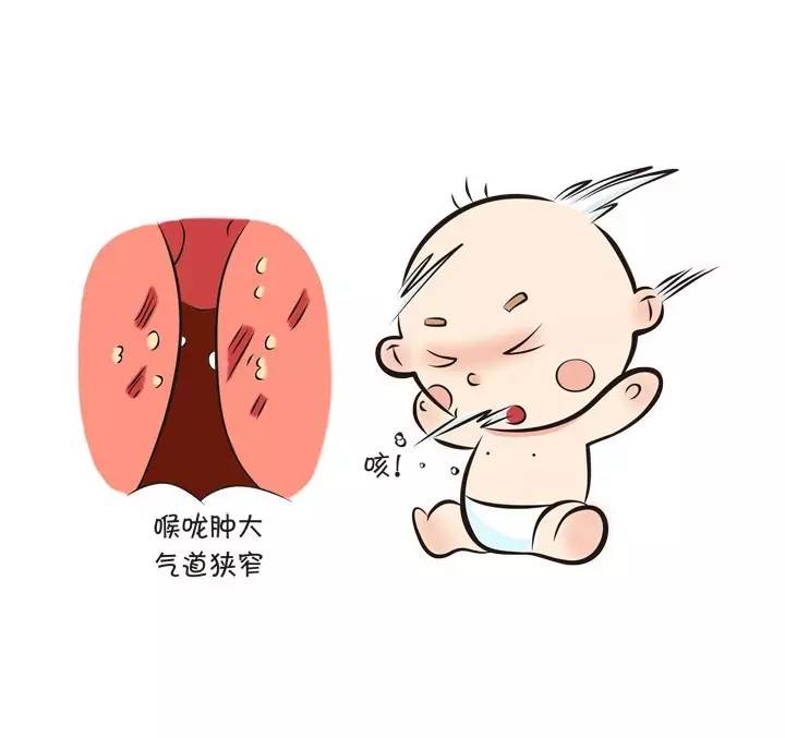 婴儿咳嗽鼻子呼哧呼哧是感冒了么,婴儿咳嗽有鼻涕呼哧呼哧怎么办