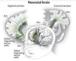 新生儿大脑活动或可破解帕金森、癫痫等医学难题