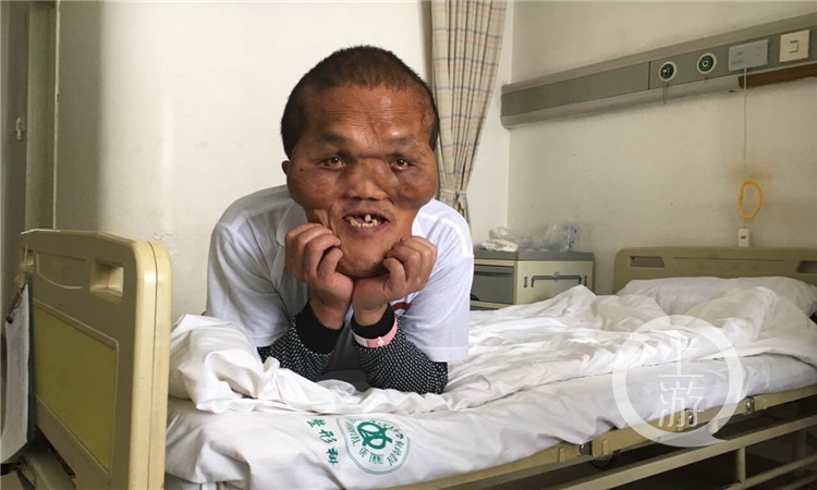 “外星人”男子来重庆主城逆袭：想整容！