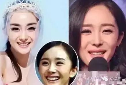 爱笑的女孩只有法令纹,果然爱笑的女孩法令纹很重了