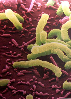 治疗幽门螺旋杆菌的中药上市公司,幽门螺旋杆菌阳性吃中药还是西药