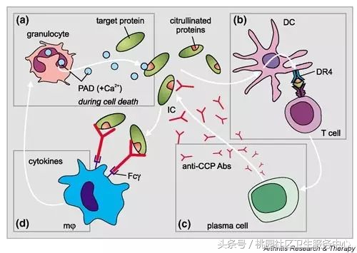 教你两步搞定类风湿关节炎,类风湿关节炎用土方法一招自愈