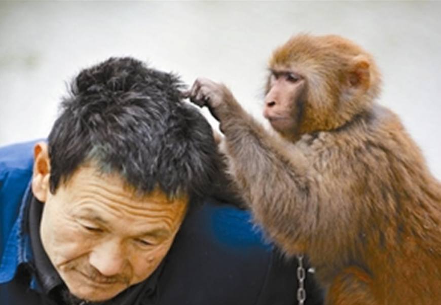 80年代头上为什么会有虱子,30年前都有虱子