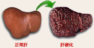 最容易被忽视的5种健康生活方式,最容易被忽视的健康生活方式