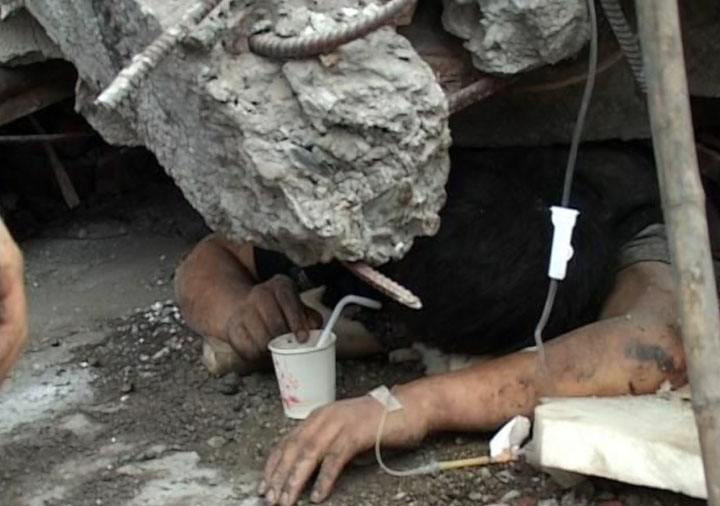 压伤多久开始消肿化瘀,压伤多久能恢复