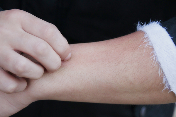 缺乏维生素B2有什么,什么原因会造成维生素b2的缺乏