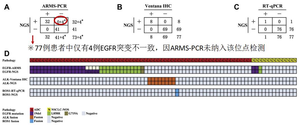 孙加源门诊,治疗肺癌的新技术新手段