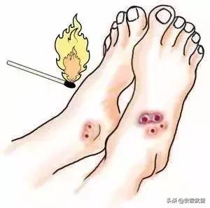 蛇在什么情况下才会主动攻击人,蛇会互相攻击吗