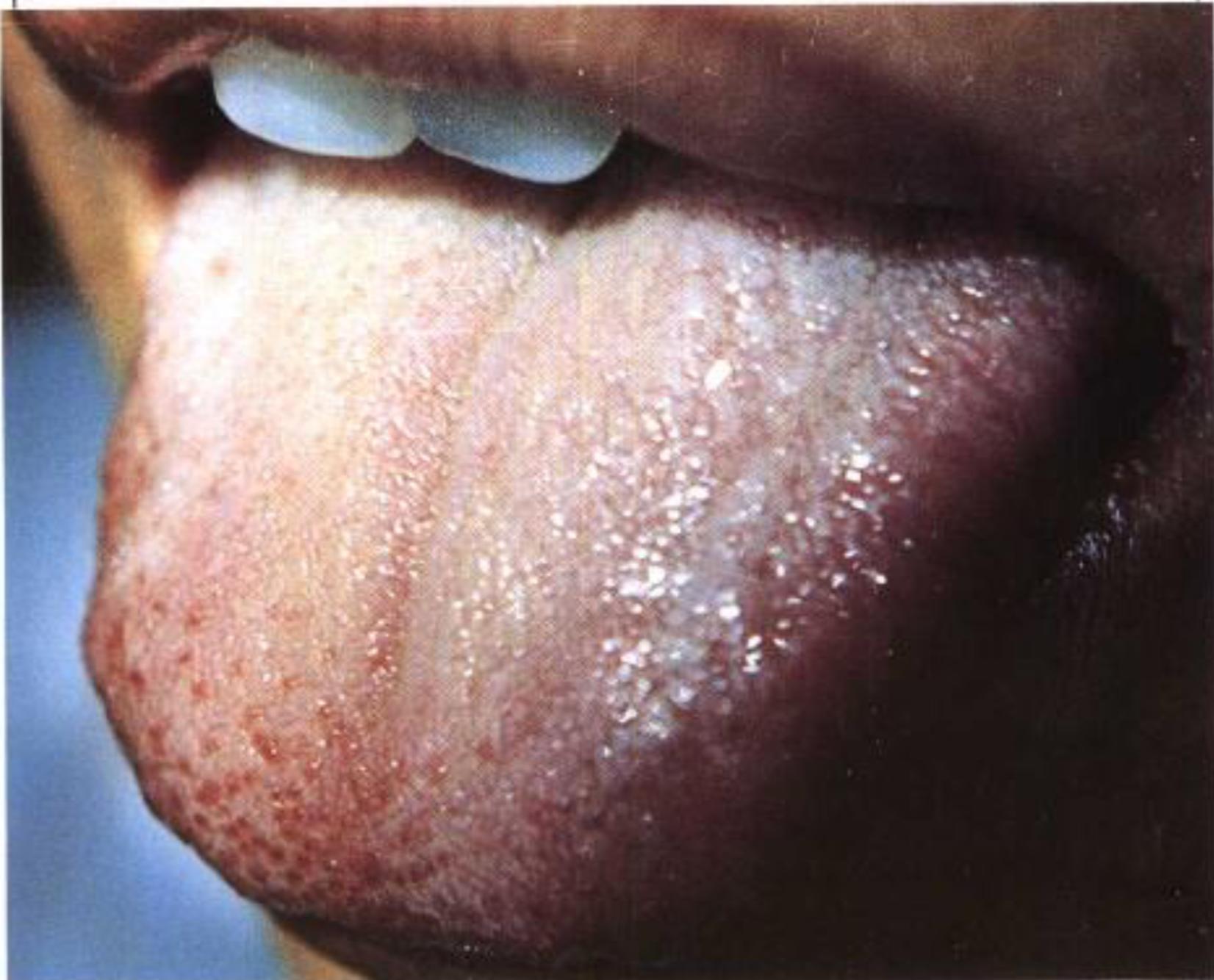 如何从舌苔判断健康,怎样通过舌苔颜色判断身体状况