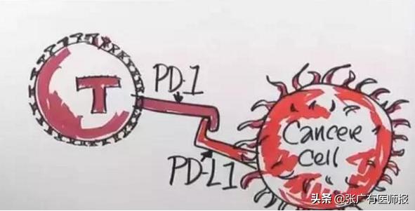 抗癌神针pd1科普小结,pd1抗癌新药现在可以用吗