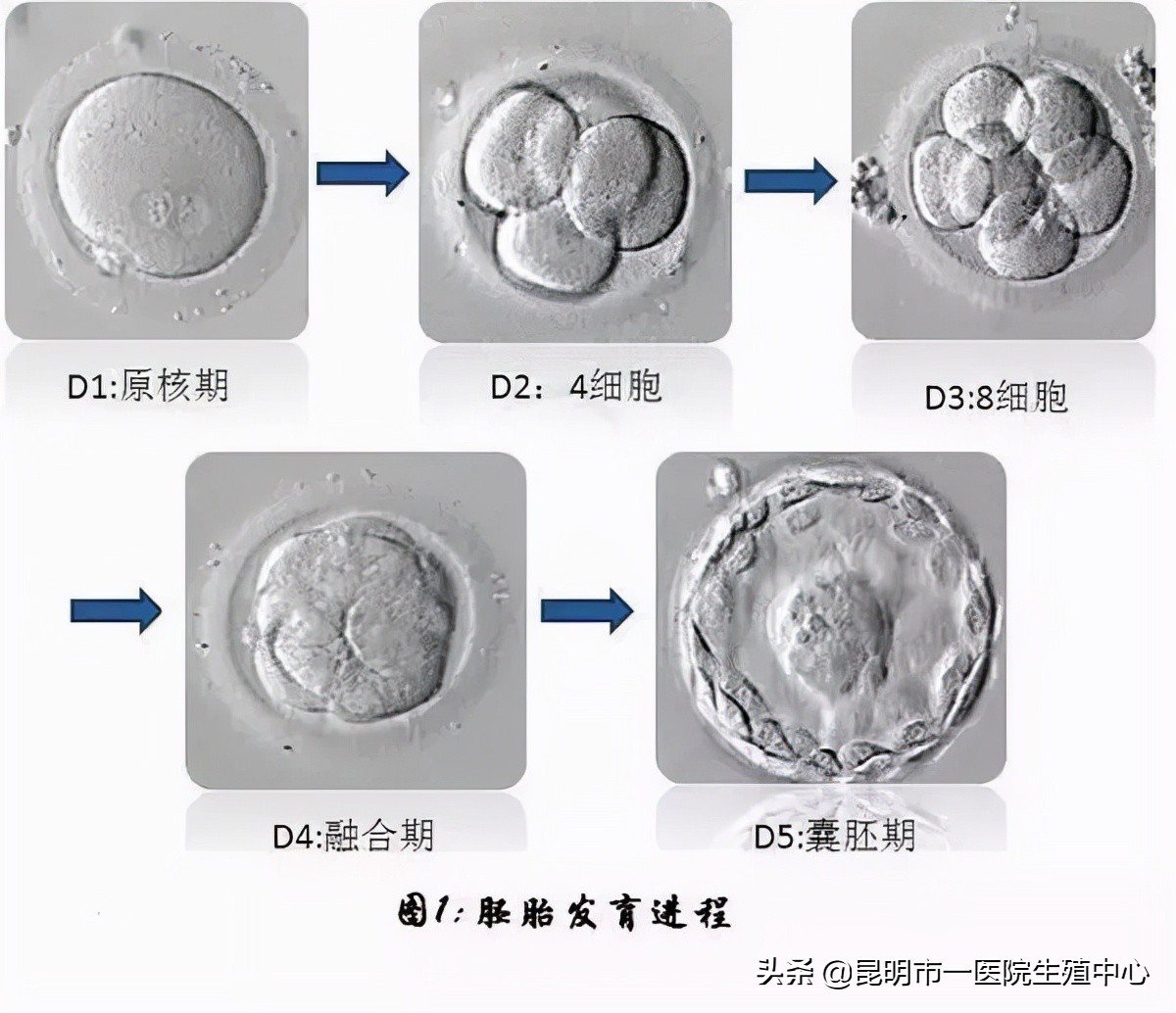 试管小白——“顶流”级别的胚胎长啥样？