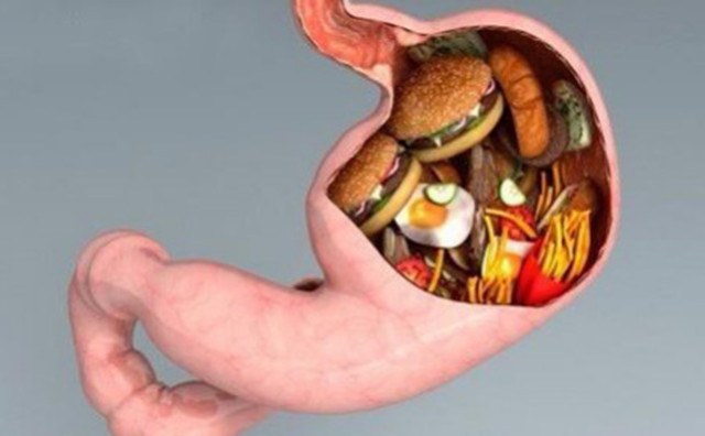 所有的肠癌都是由肠息肉演变的吗,所有肠癌都是肠息肉发展来的吗