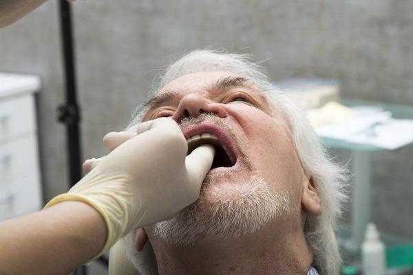 嚼槟榔口腔粘膜受损严重怎样修复,嚼槟榔口腔内壁发白多久可以恢复