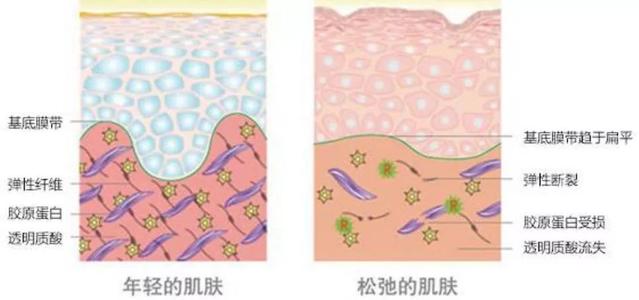 减肥沐浴露真的好使吗,用瘦身沐浴露真的可以瘦身吗