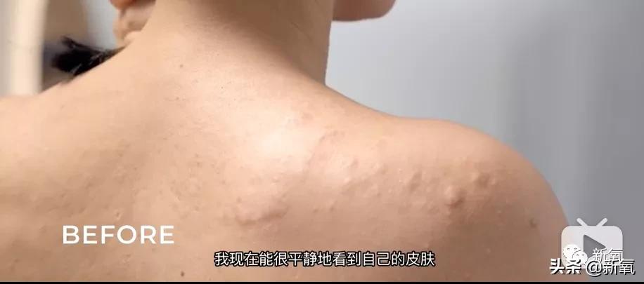 刘诗诗最近生图,刘诗诗旧照脸又胖又大