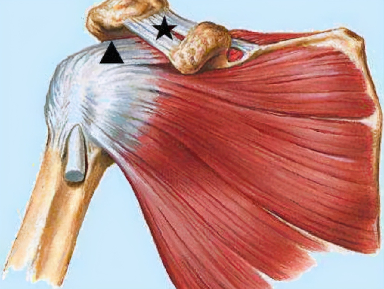 如何让拜拜肉瘦下去,拜拜肉一直减不掉怎么办