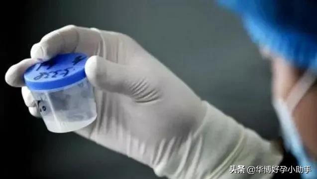 精子颜色为灰色有没有问题,精子的颜色有点灰红色