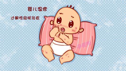 湿疹痒吗婴儿会因为湿疹哭闹吗,宝宝得了湿疹半夜痒睡不着怎么办