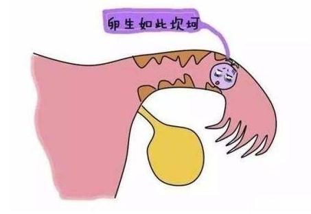 专治不孕不育输卵管疏通祖传秘方,输卵管不孕指南