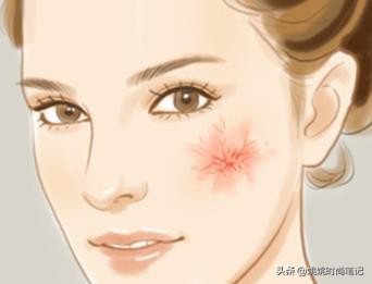 春季皮肤过敏干燥起皮怎么办,过敏是皮肤干燥引起的吗