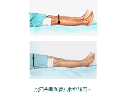 骨科术后康复训练要多久,骨科手术20天后恢复