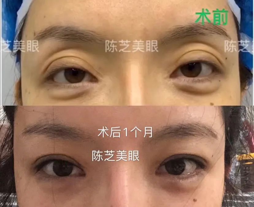 明明年纪不大却很显老态,明明年纪很小但是脸很显老