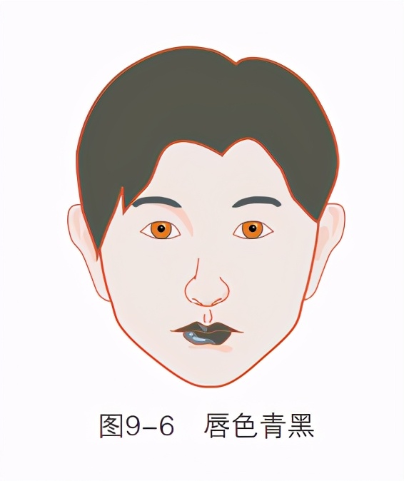 唇色异常有哪几种表现,唇色发白预示什么病症