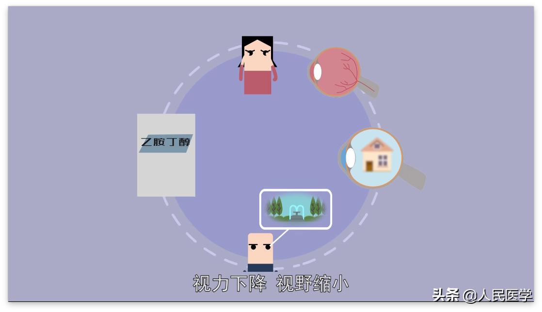 有没有吃药后视力模糊的体验?这些药物用药后可能影响视力
