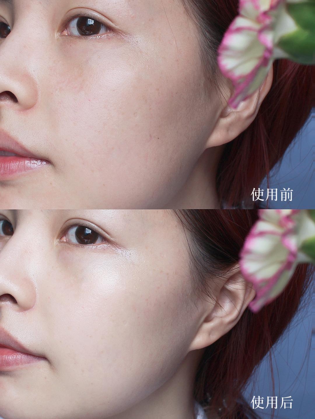 适合皮肤泛红角质层薄的大牌面霜,换季补水抗皱面霜