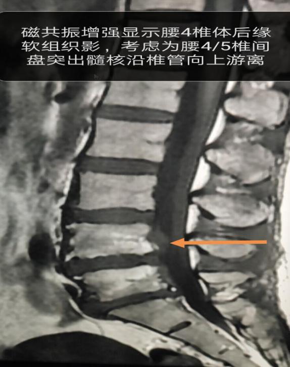 那天，市第二人民医院收到一件特殊的包裹……