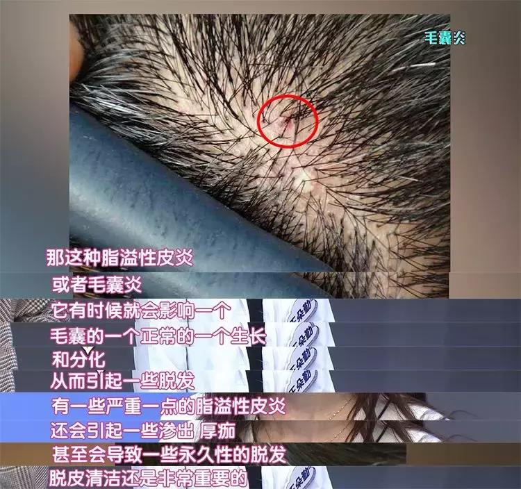 樱花头皮护理,樱花护发精油改善干枯防毛躁滋润