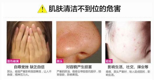 下巴反复长痘痘的原因和解决方法,下巴老是长痘痘怎么调理身体啊