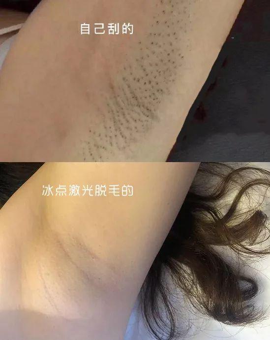 脱毛好物推荐,超平价脱毛推荐