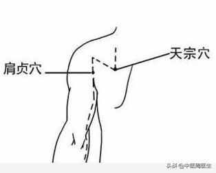如何调理肩颈淤堵,怎样治疗肩颈僵硬疼痛